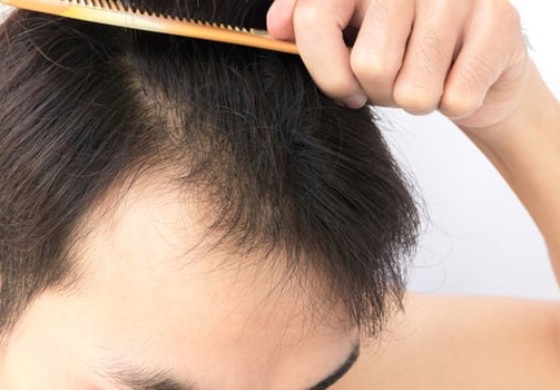 Can Biotin Shampoo Help With Hair Shedding?